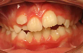 Smiles by Smith Case 1 before