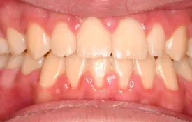 Smiles by Smith Case 8 after