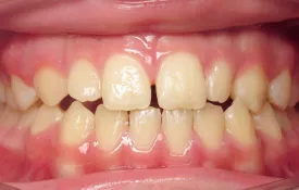 Smiles by Smith Case 8 before