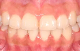 Smiles by Smith Case 8 after
