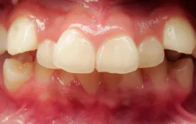Smiles by Smith Case 8 before
