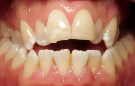 Smiles by Smith Case 8 before