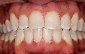 Smiles by Smith Case 8 after