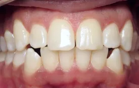 Smiles by Smith Case 8 before