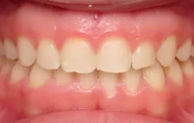 Smiles by Smith Case 8 after