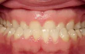 Smiles by Smith Case 8 before