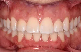 Smiles by Smith Case 8 after