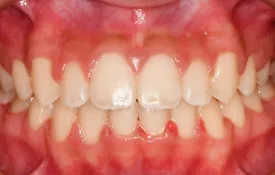 Smiles by Smith Case 8 after