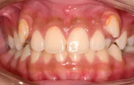 Smiles by Smith Case 8 before